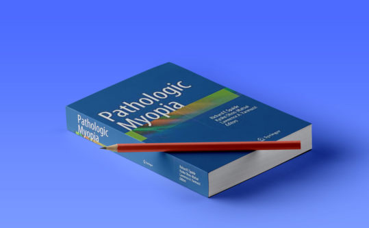 Pathologic Myopia book, published by Macula Foundation supporters